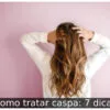 Como tratar caspa: 7 dicas