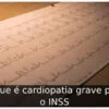 O que é cardiopatia grave para o INSS