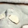 Qual procedimento para fechar os poros do rosto Qual procedimento para fechar os poros do rosto